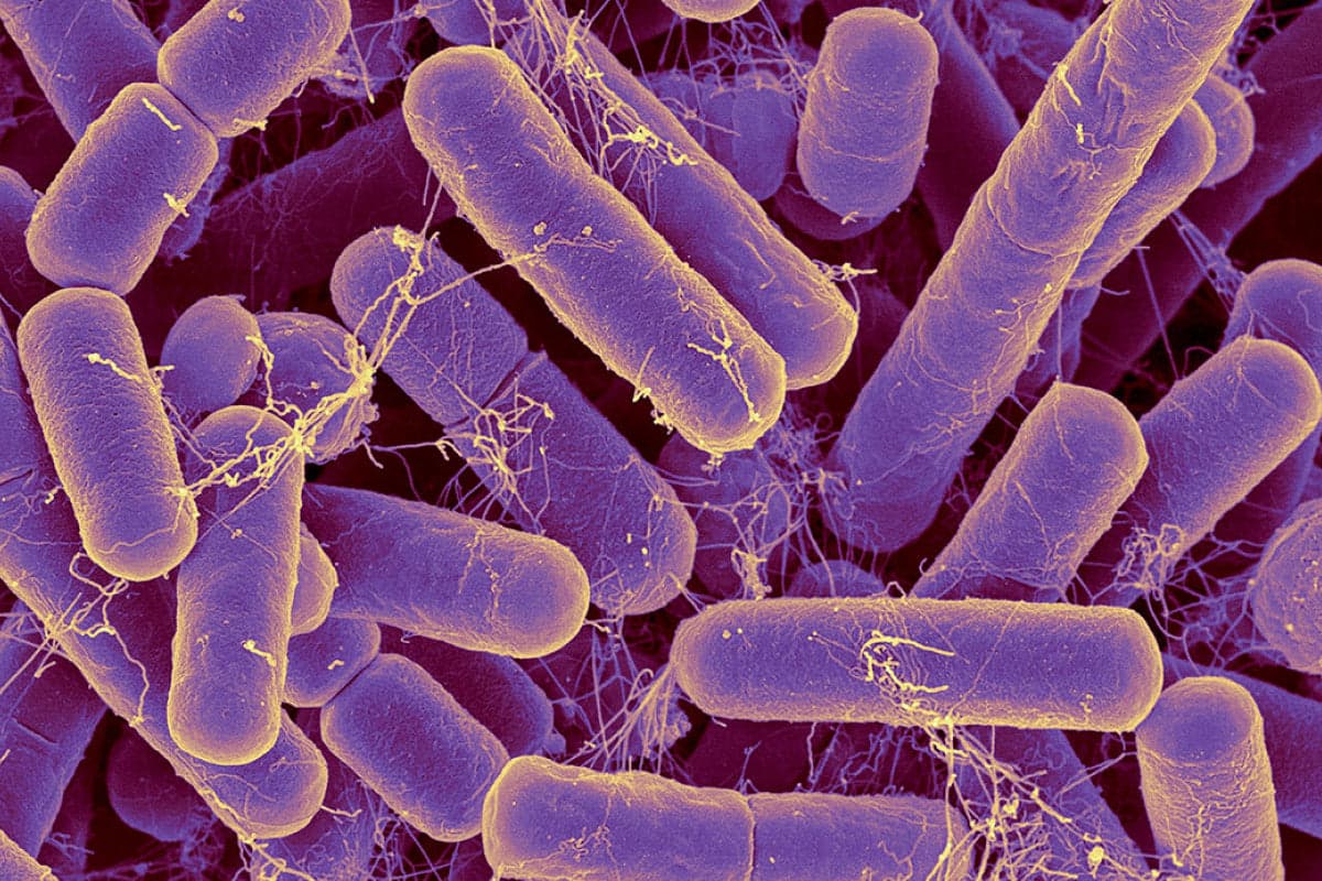 The Gut Microbiome And IBS: Connection Between Gut Bacteria And Digestive Symptoms